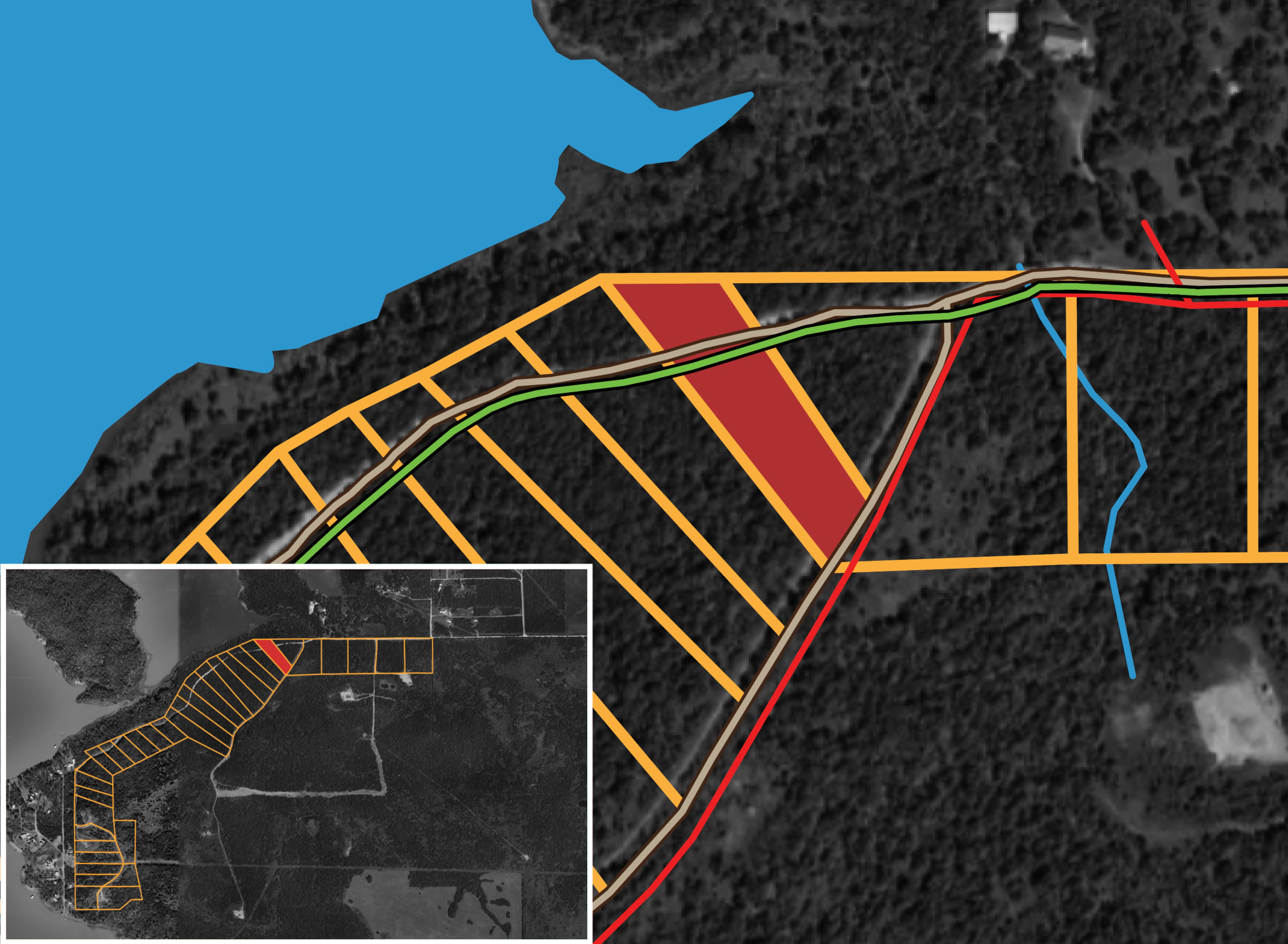 RCCPI-T7 tract image